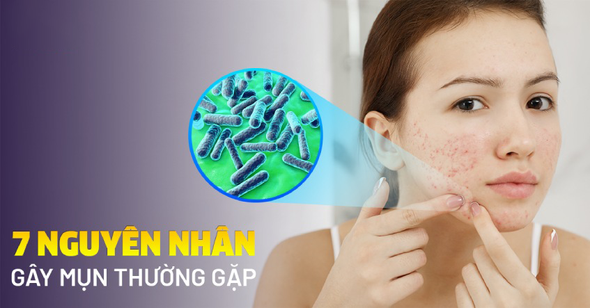 TOP 7 NGUYÊN NHÂN GÂY MỤN PHỔ BIẾN VÀ NHỮNG ĐIỀU CẦN LƯU Ý