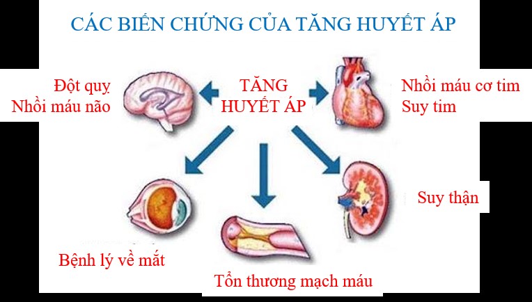 Tăng huyết áp: Các nguy cơ và biện pháp kiểm soát